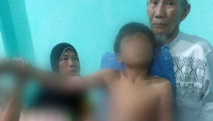 Disengat Listrik, Anak Umur 8 tahun Asal Lombok Terpental 1 Meter dan Dilarikan Ke Rumah Sakit